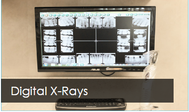 The monitor LCD shows a digital image of the teeth's X-rays.